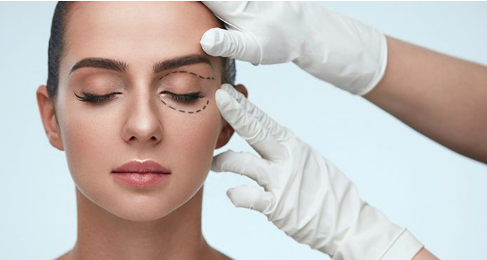 Cataract Surgery