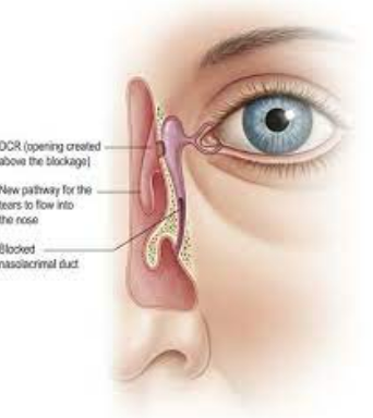 Eye Check-Up