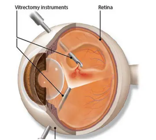 Eye Check-Up