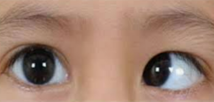 Eye Check-Up